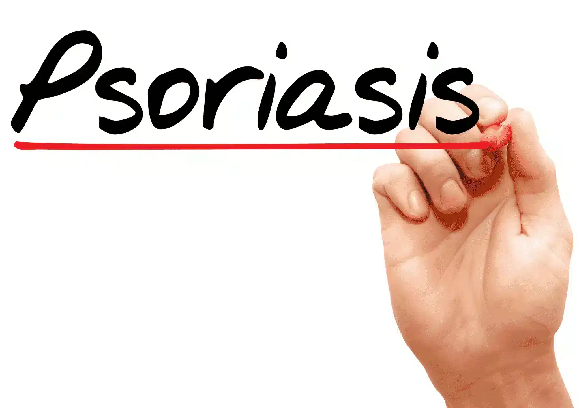 psoriasis