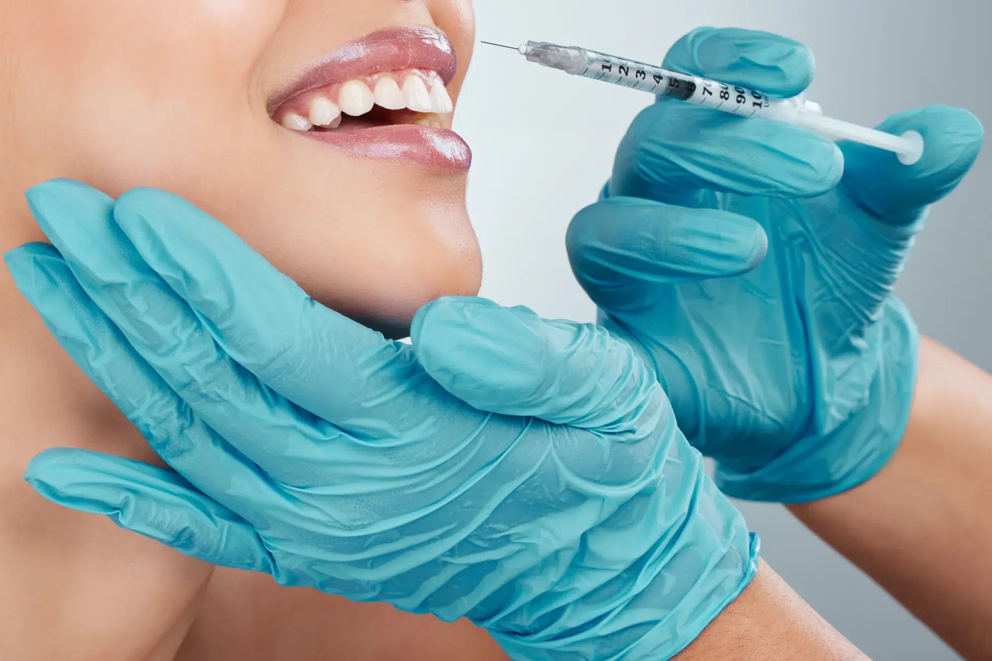 A close-up of a smiling person's face, with another's gloved hands gently holding their chin and cheek. A syringe hovers near the lower part of their face, suggesting an injection procedure for Juvederm Voluma Lips. Both hands are donned in blue medical gloves.