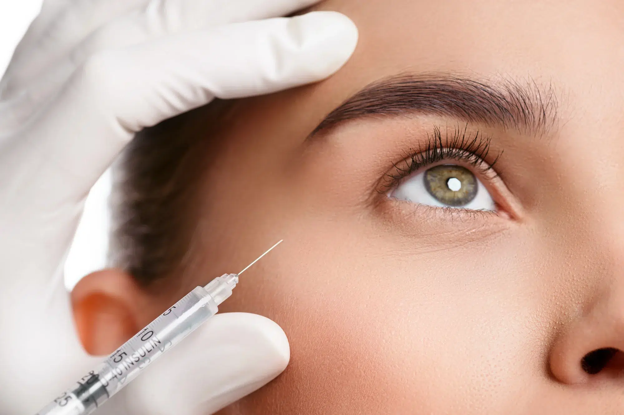 A close-up of a person's face receiving a Botox injection near the eye from a gloved professional. The syringe is aimed at the area between the eye and eyebrow, indicating a cosmetic or medical procedure. The person's eye is open and looking upwards.