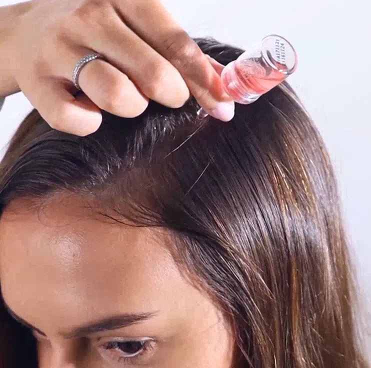 A woman applies the Calecim Advanced Hair System serum on her scalp.