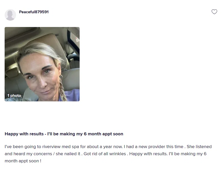 A testimonial from a patient who got Botox injections for their facial skin aging concerns.