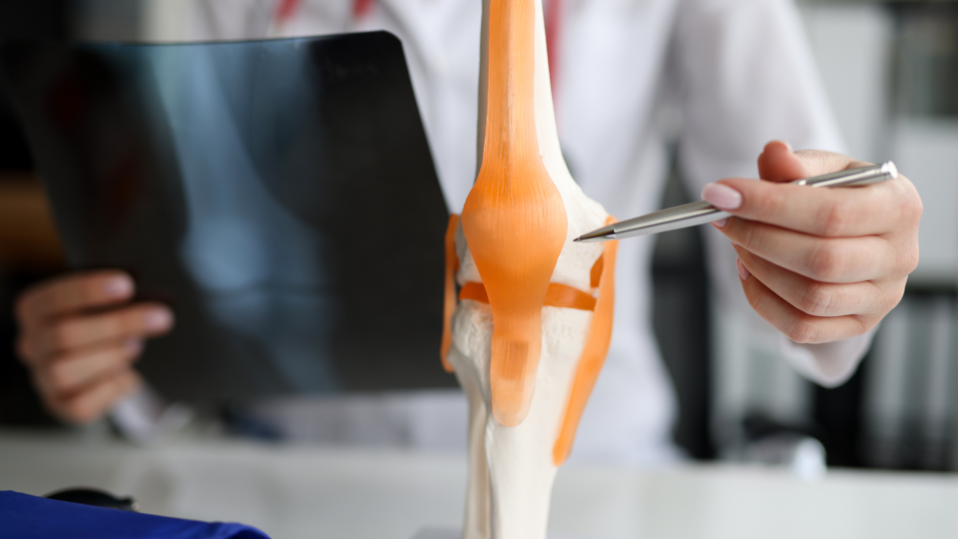 A medical professional educating patients with the knee joints.