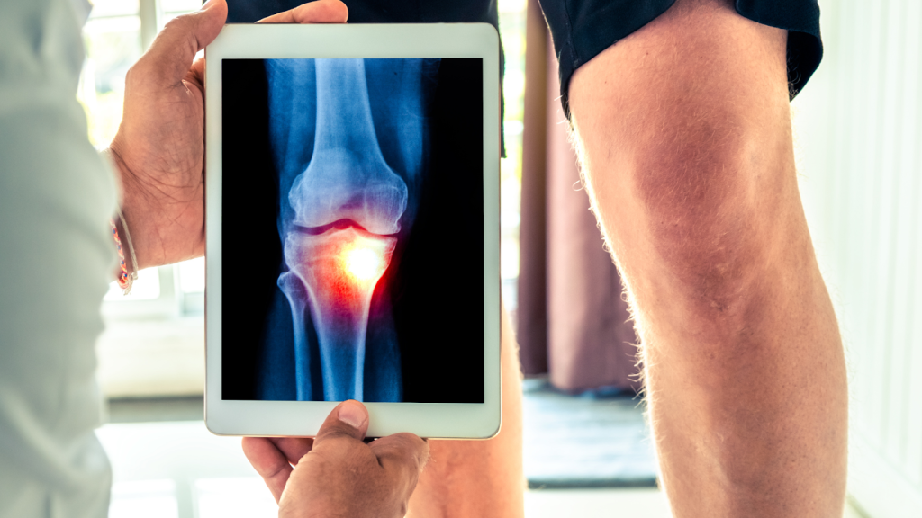 A healthcare provider examining the knee joint.