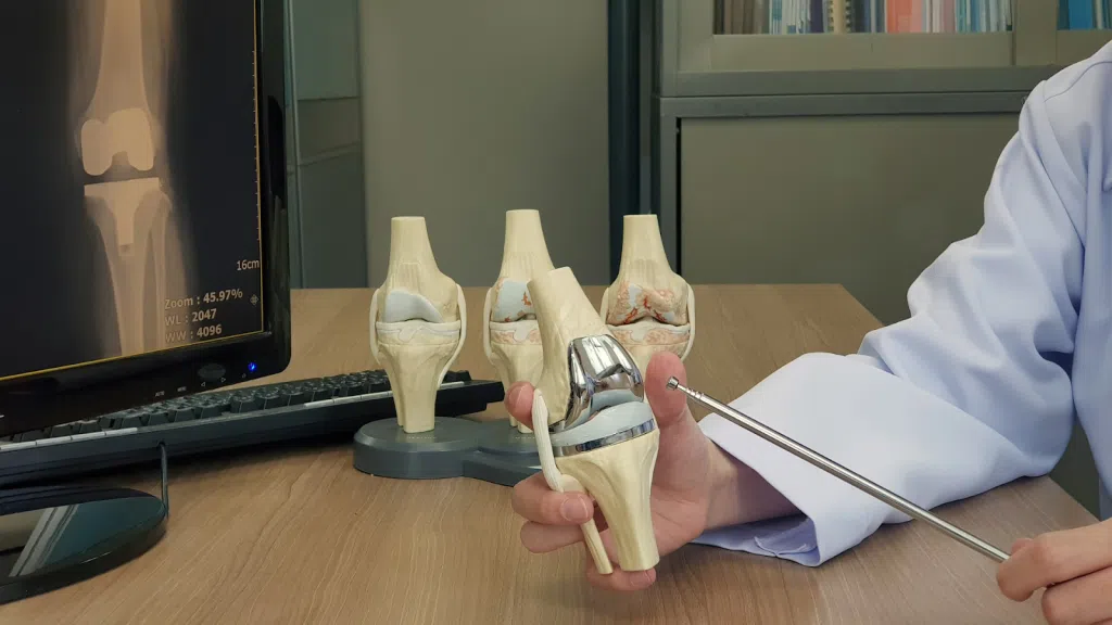 A medical professional explaining the knee joint.