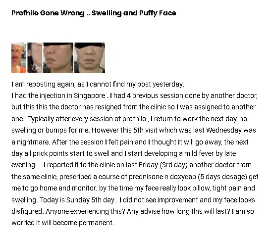 A patient review after their Profhilo treatment.