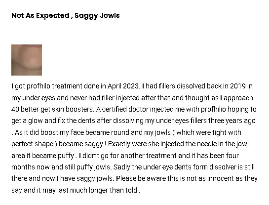A Profhilo-treated patient shared their positive experience during the treatment.