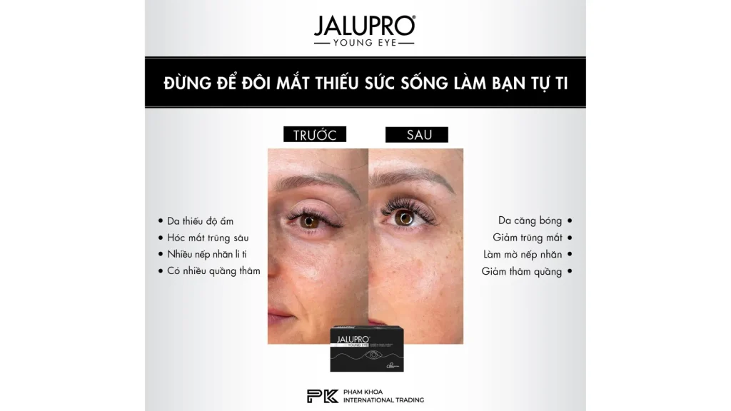 A patient's before and after photos of their Jalupro Young treatment, showing significant improvements.