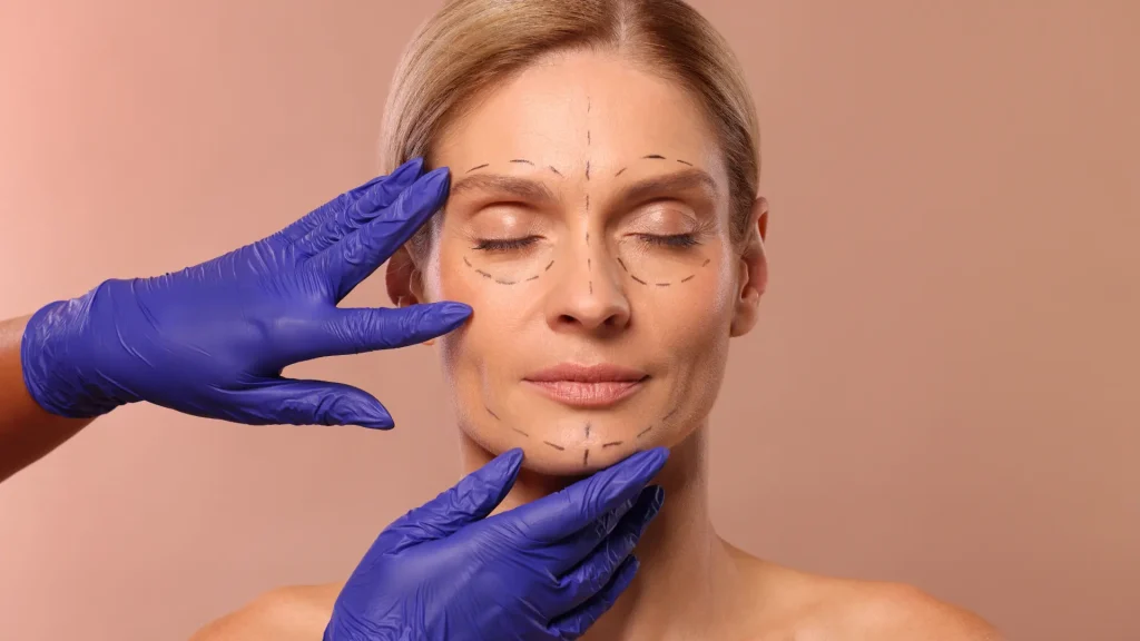 A medical professional marking the facial regions for injections.