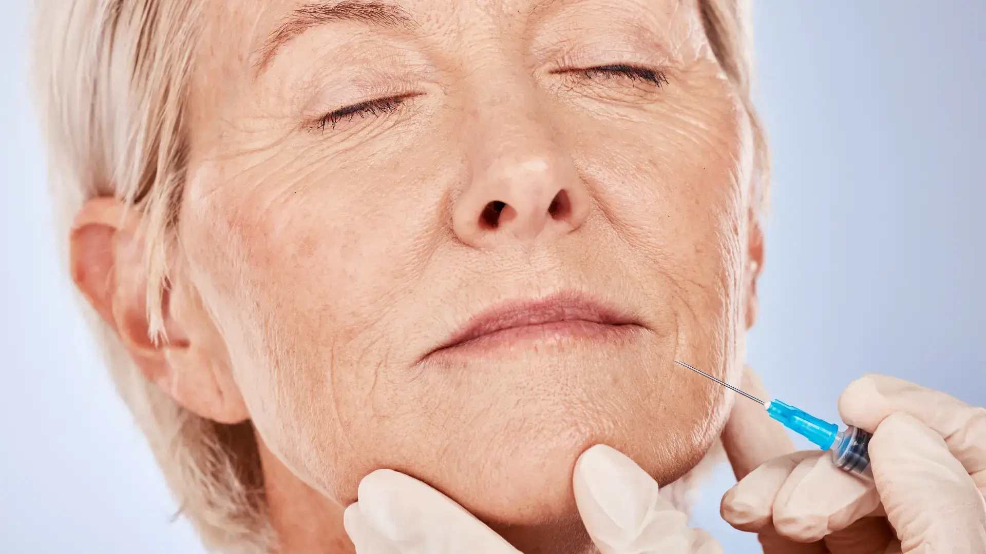 An older patient receiving injection for their smile lines.