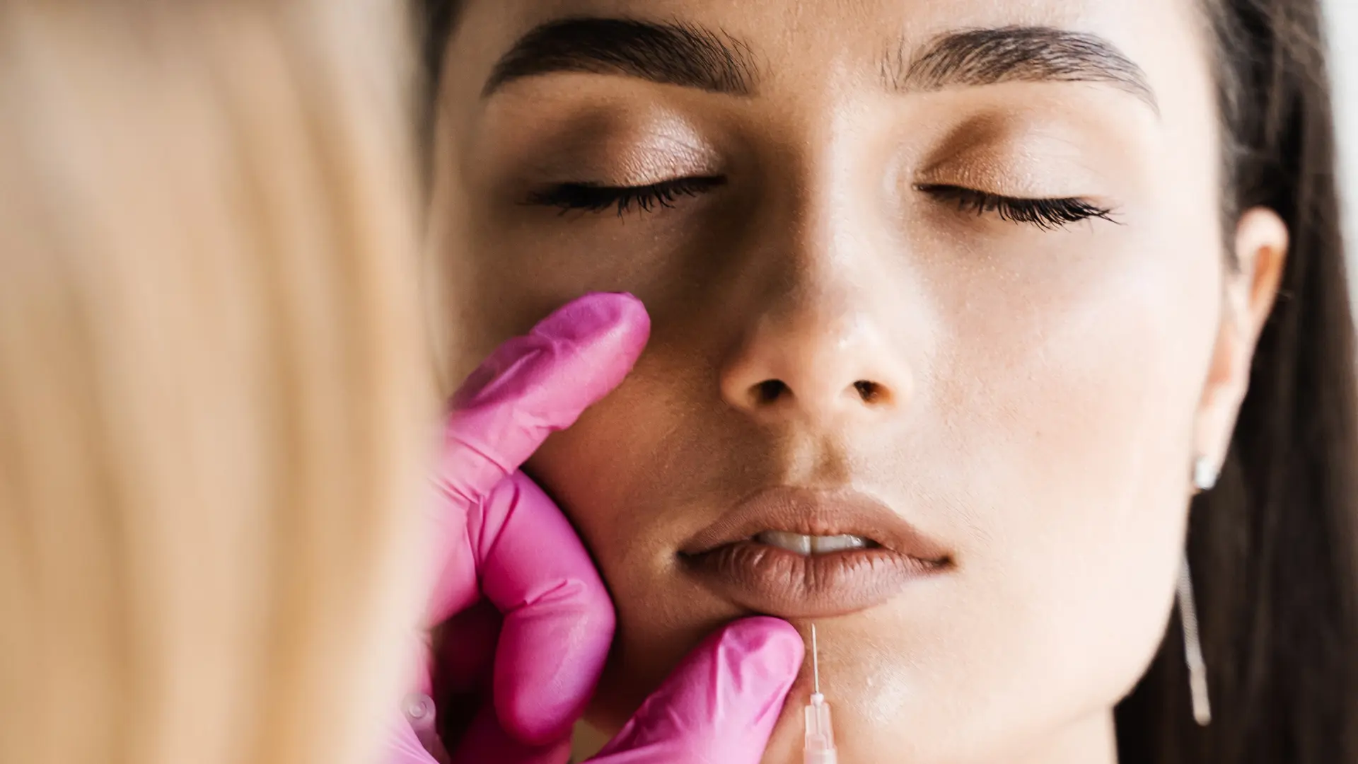 A medical professional administering lip injection into the patient's pout.
