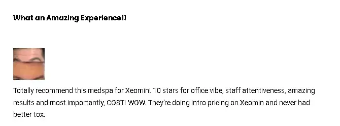 A Xeomin-treated patient's testimonial on the safety and efficacy of the injectable treatment.