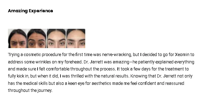 A Xeomin patient's positive review on their forehead injection treatment.
