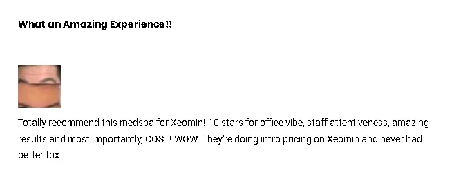 A Xeomin patient's satisfied review on RealSelf about their forehead lines treatment.