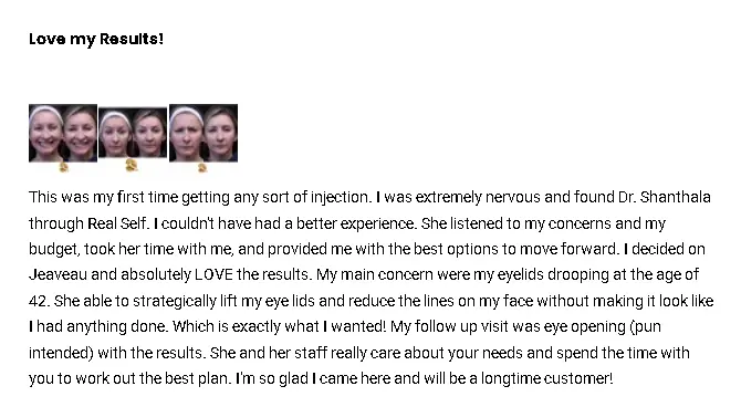 A patient review on the effective results of their Jeuveau treatment.
