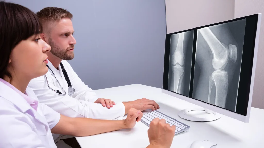 Medical professionals examining the x-ray of a patient's knee.