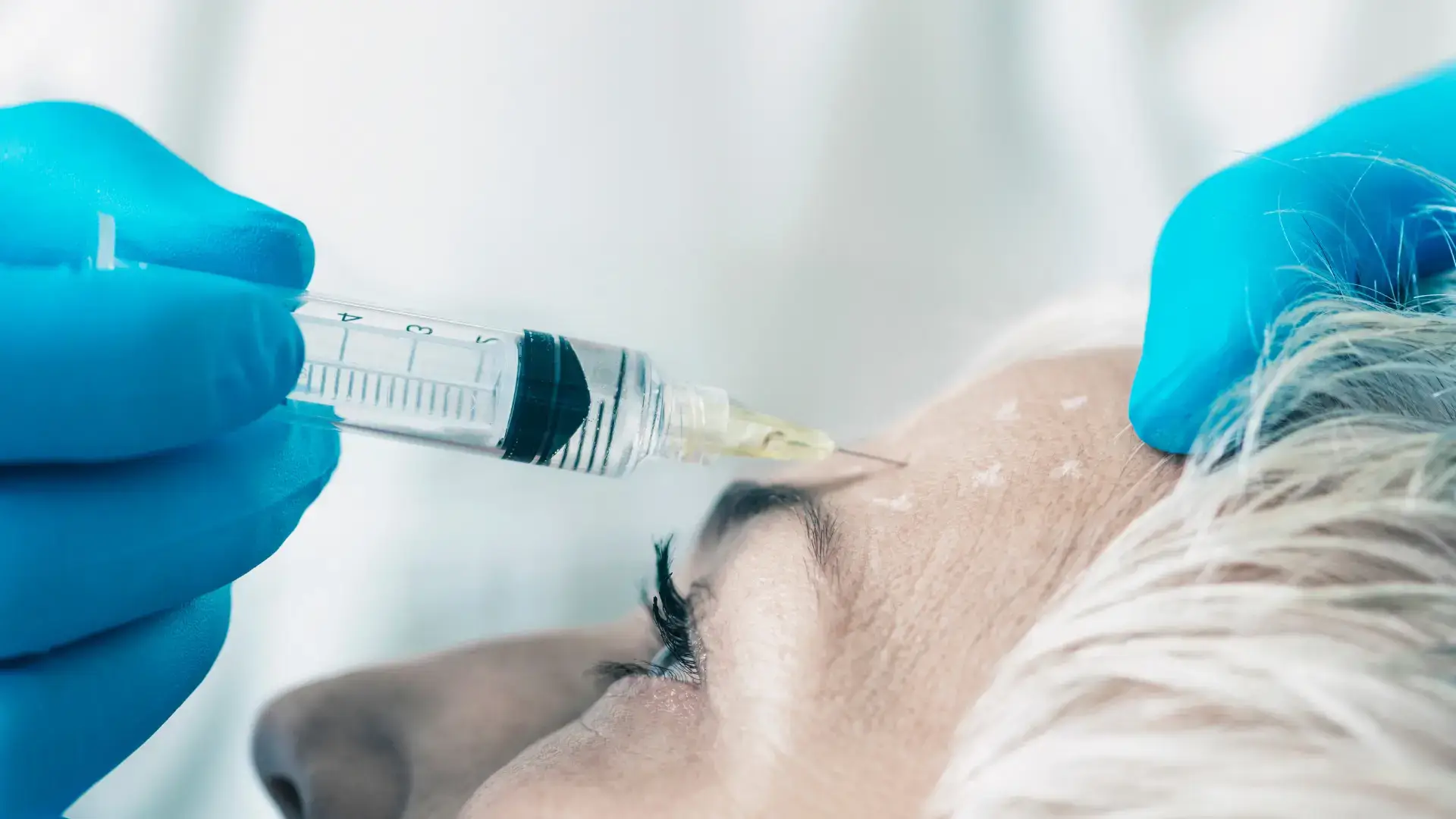 An individual receiving an injection into their forehead lines.