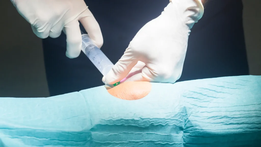 A medical professional administering an injection into a patient's knee.