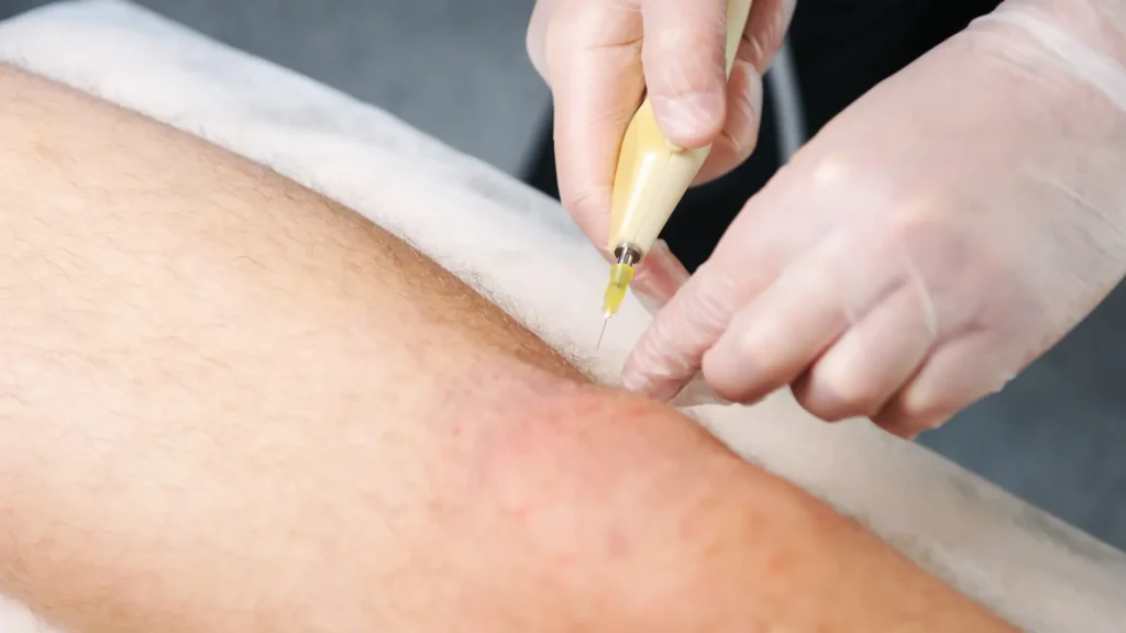 A medical provider administering a knee injection.