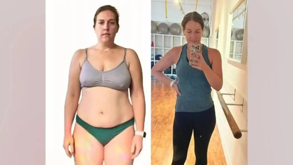 An individual showing their before and after photo of their Semaglutide treatment for weight loss.