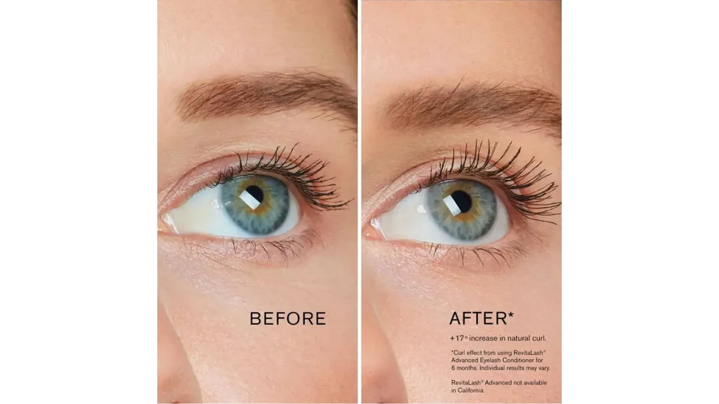 A Revitalash-treated patient's before and after photo.
