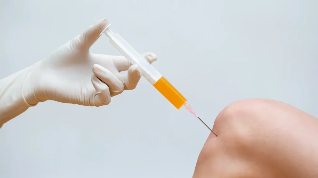 An injection directly administered into a patient's knee joint.