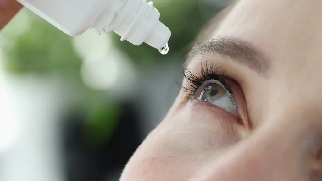 An individual applying an eyedrop into their eye.