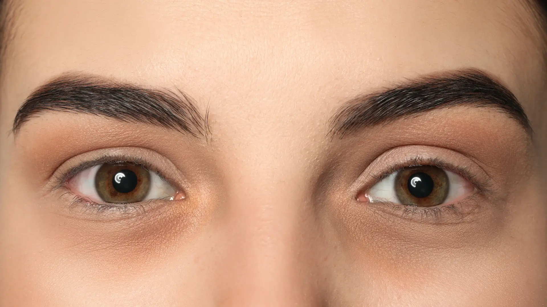 A close-up shot of an individual's dark circles under the eyes.