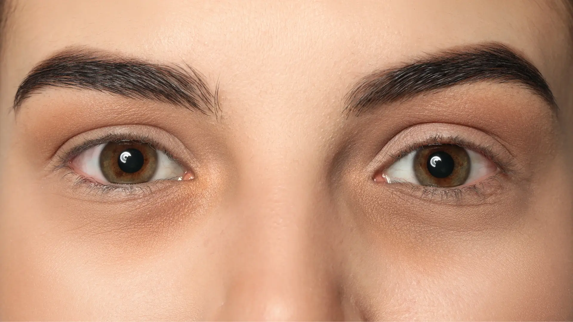 An individual dealing with dark circles under the eyes.