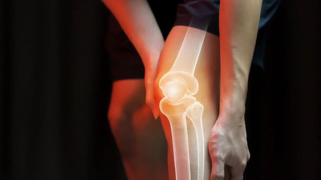 An individual suffering from knee pain.