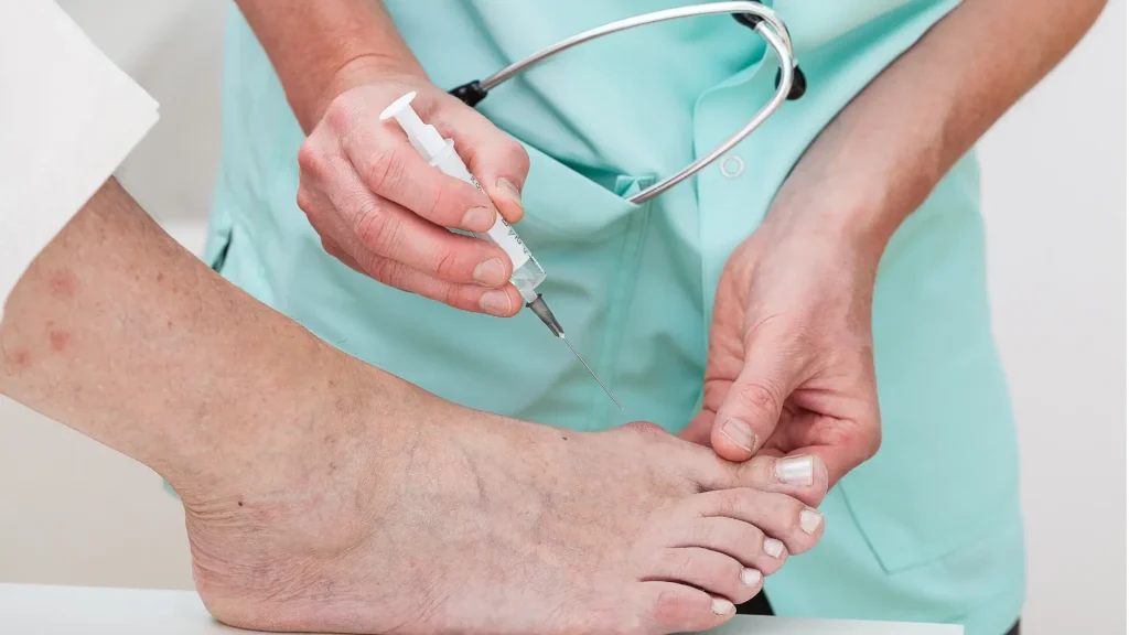 A medical professional administering an injection into a patient's bunion.