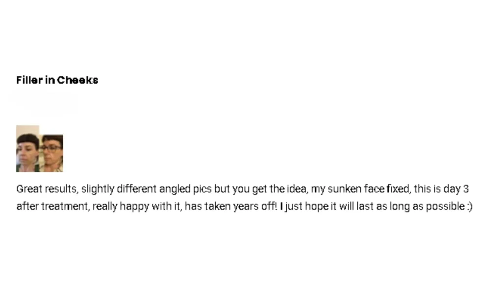 A patient testimonial of their Ellanse dermal filler treatment for cheeks.