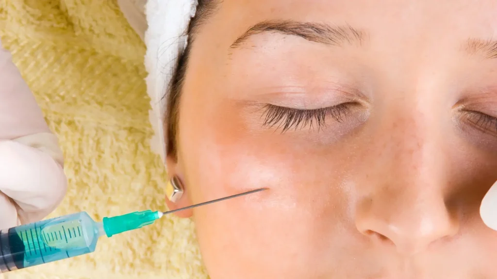 An individual receiving an injection into their cheeks.