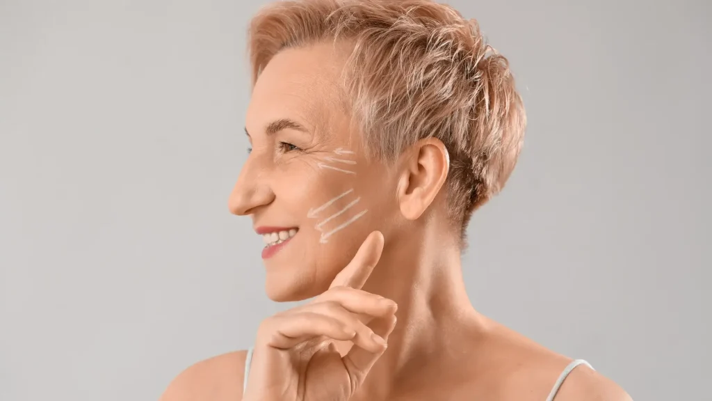 An older individual showing the aging signs on their facial region and the potential injection sites before their treatment.