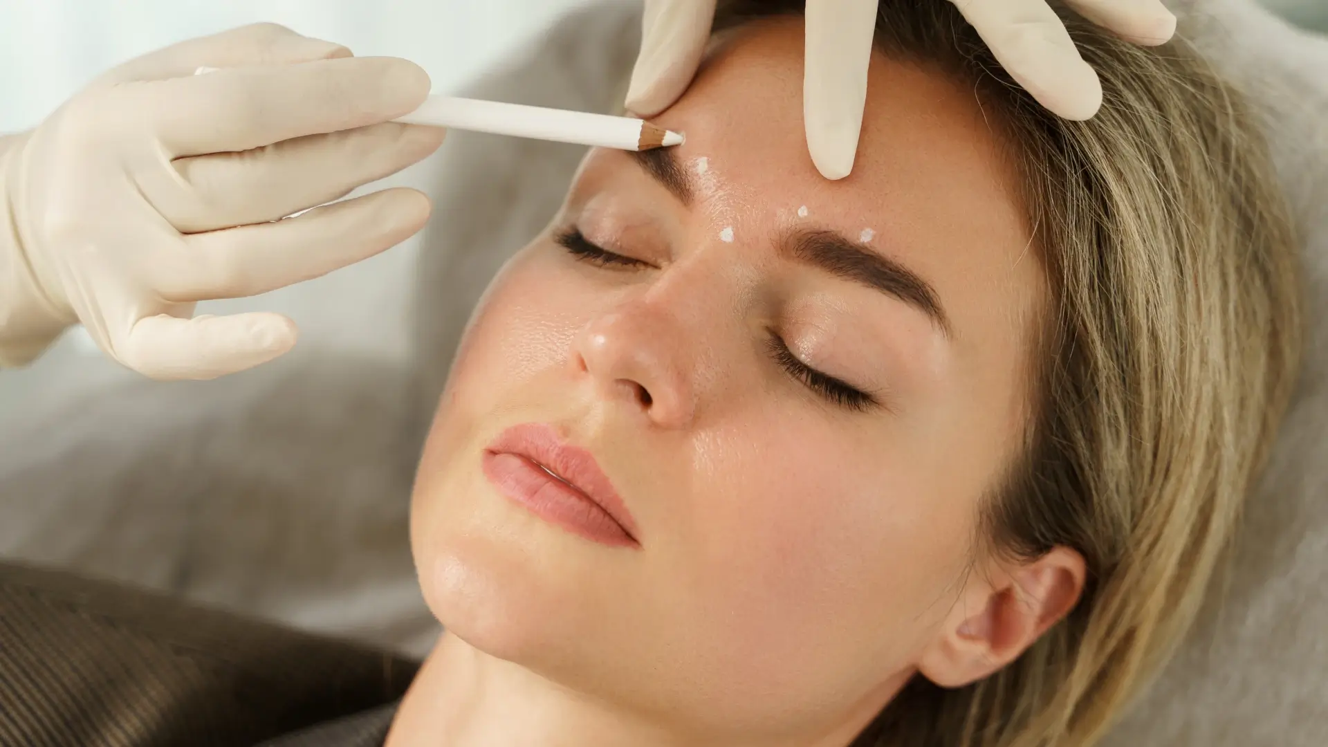 An aesthetic provider marking the injection sites for the individual's forehead treatment.