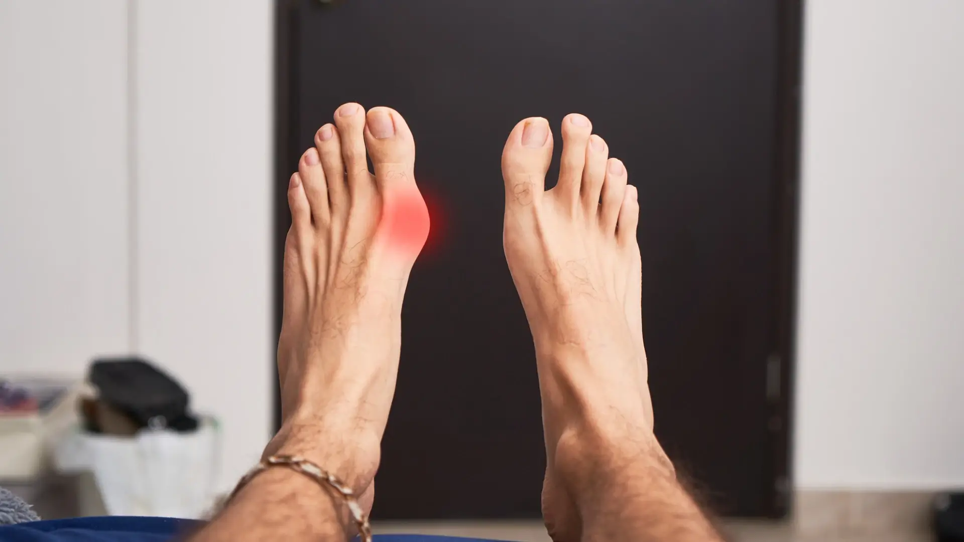 An individual suffering from bunions.