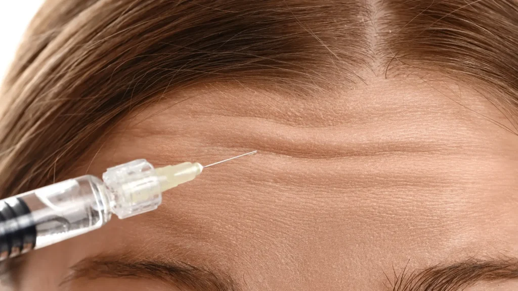An individual receiving an injection into their forehead lines.