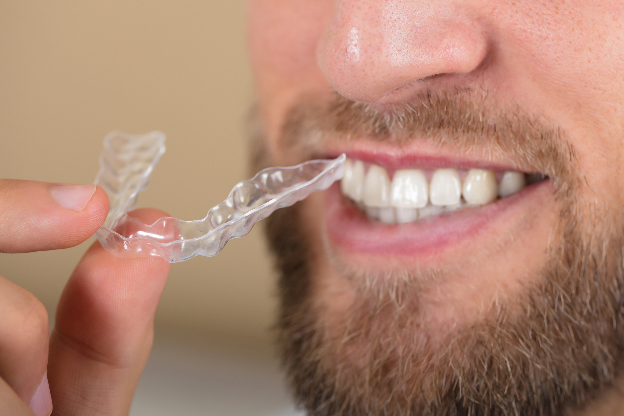 A person with a beard smiles while holding a clear dental aligner close to their teeth. The aligner is transparent and designed to fit over the teeth, suggesting use for orthodontic purposes.