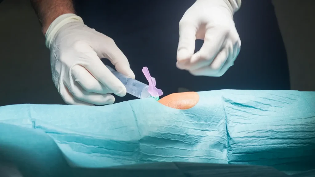 A medical professional administering a knee injection into a patient.