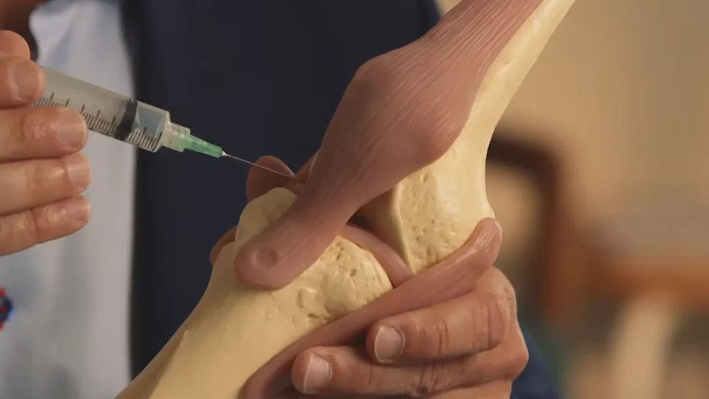 Dr. Deakon demonstrates the proper Cingal administration for maximum safety and efficacy.