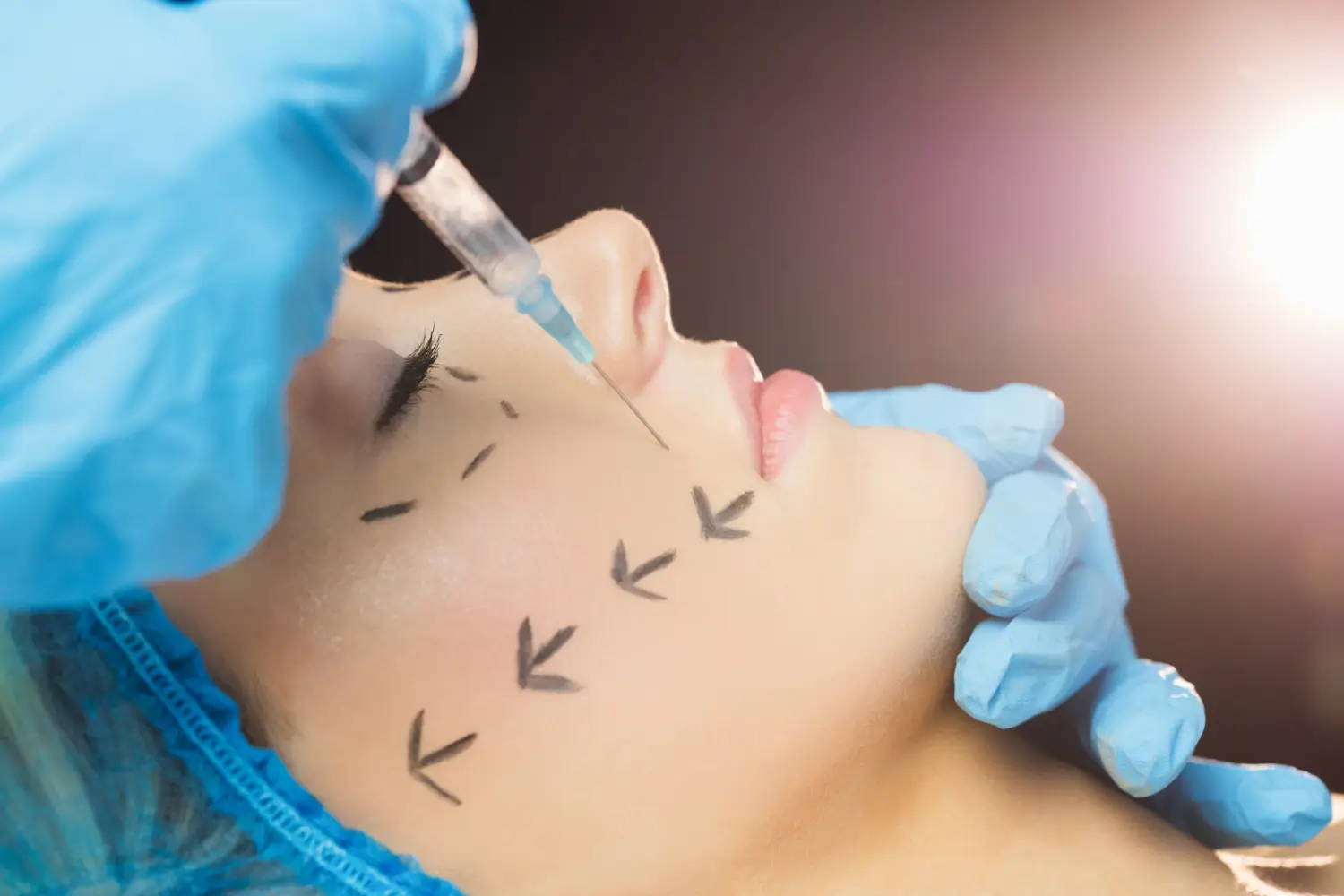 A medical professional administering injection into the marked points.