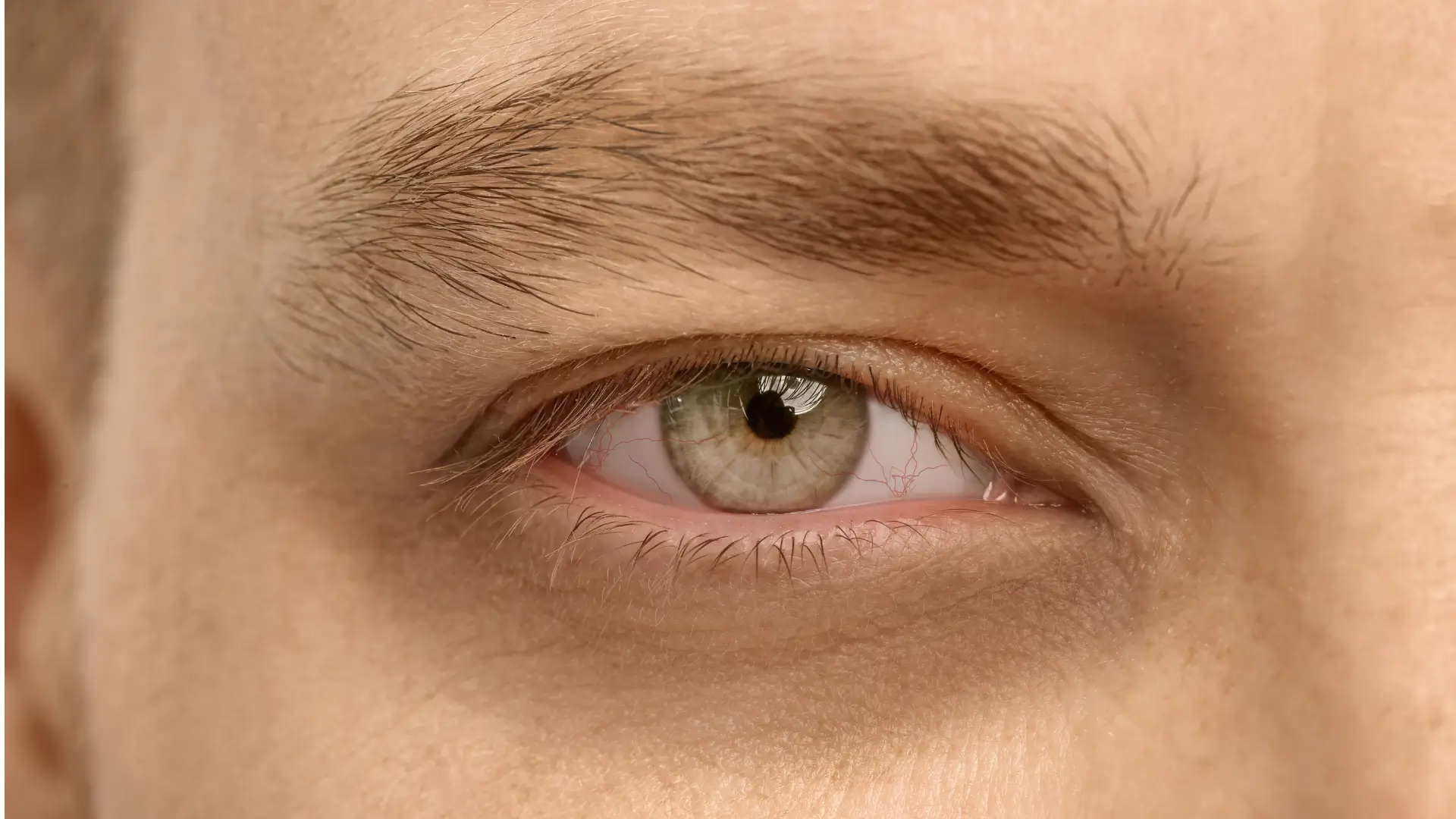 A close-up shot of an individual's eye region, focusing on the dark circles under the eye.