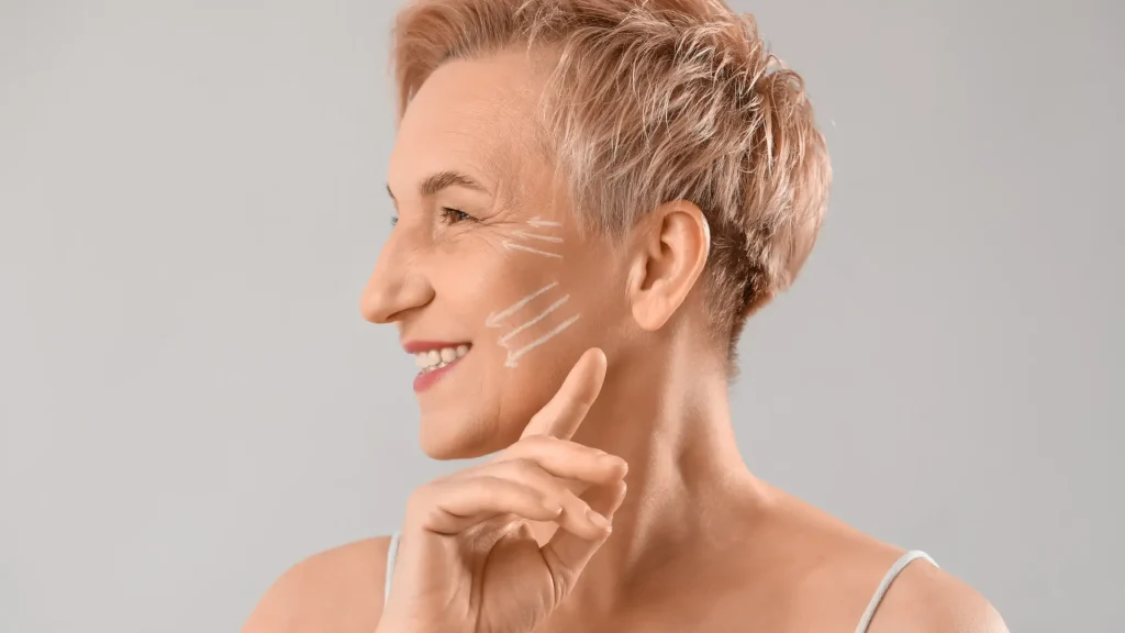 A patient showing off the injection points on their face.