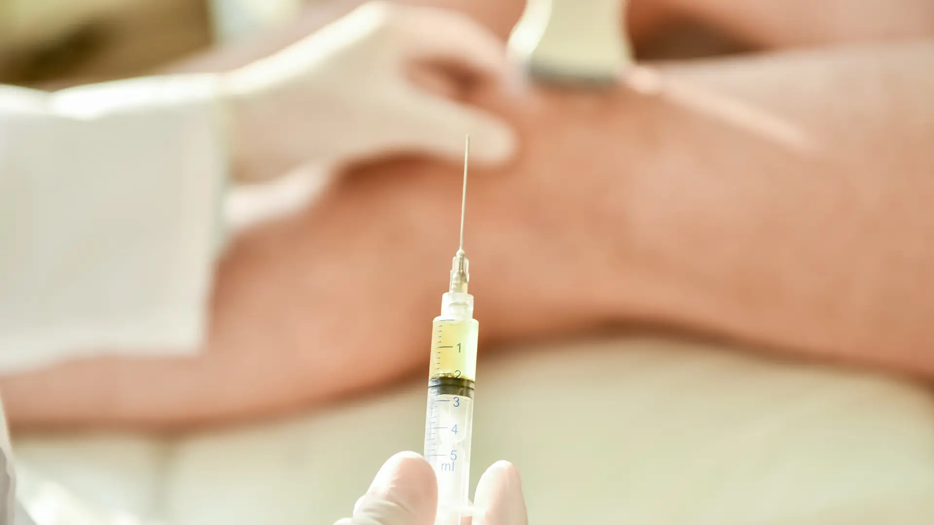 A close-up shot of a knee injection before administration into the patient's joint space.