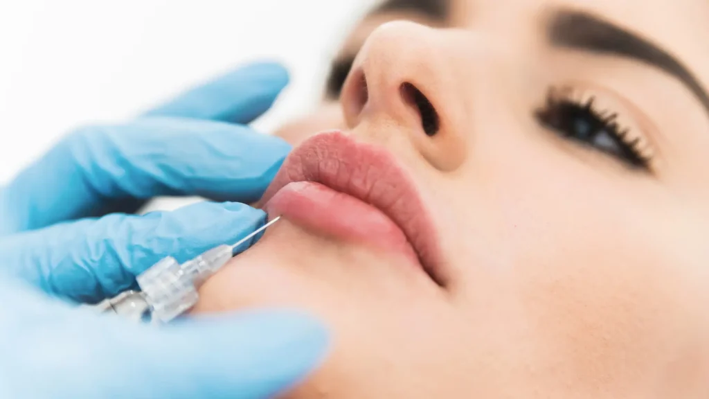 An individual receiving their lip filler injection from a practitioner.
