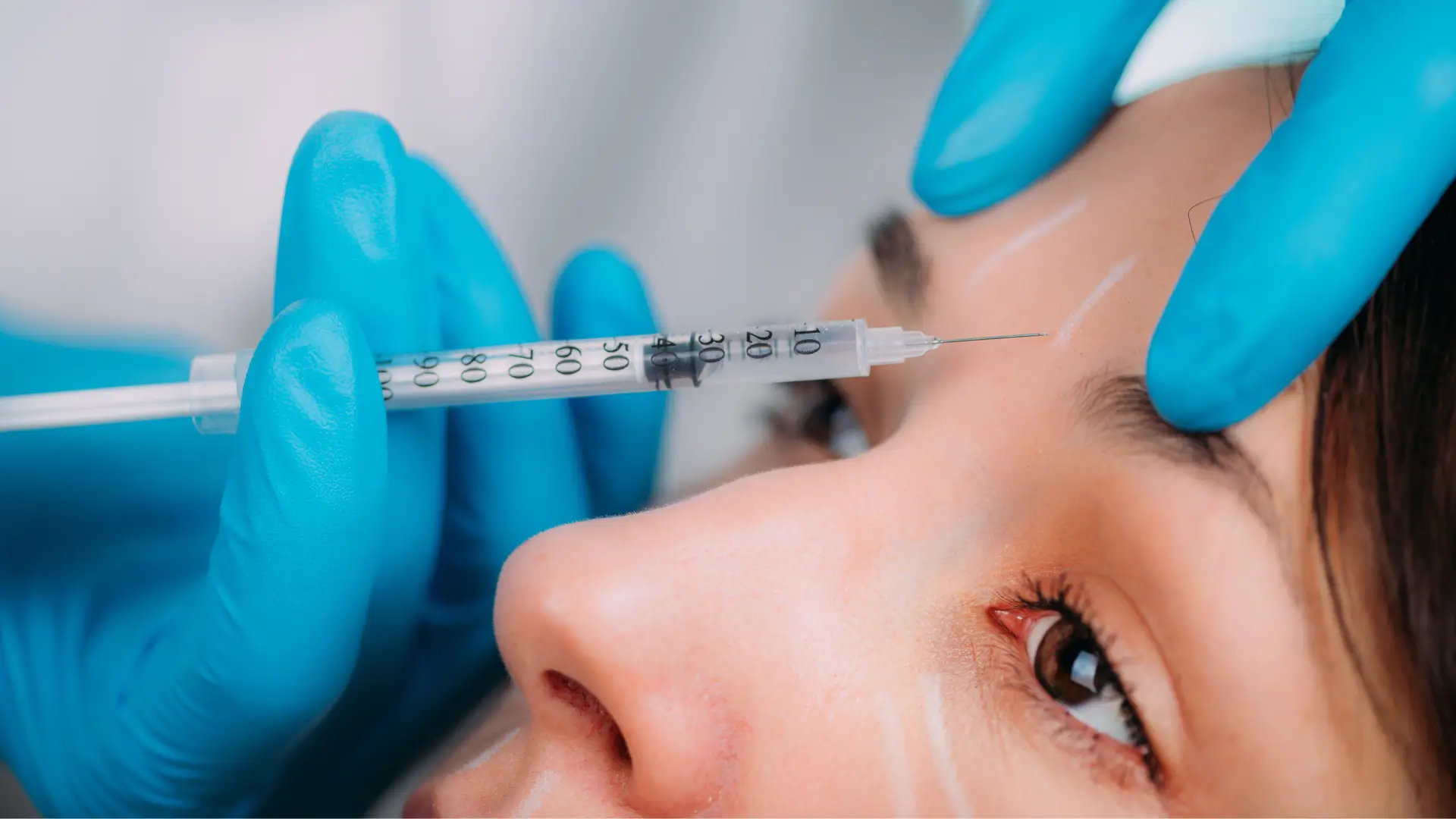 A medical professional administering an injection into a patient's '11' lines.