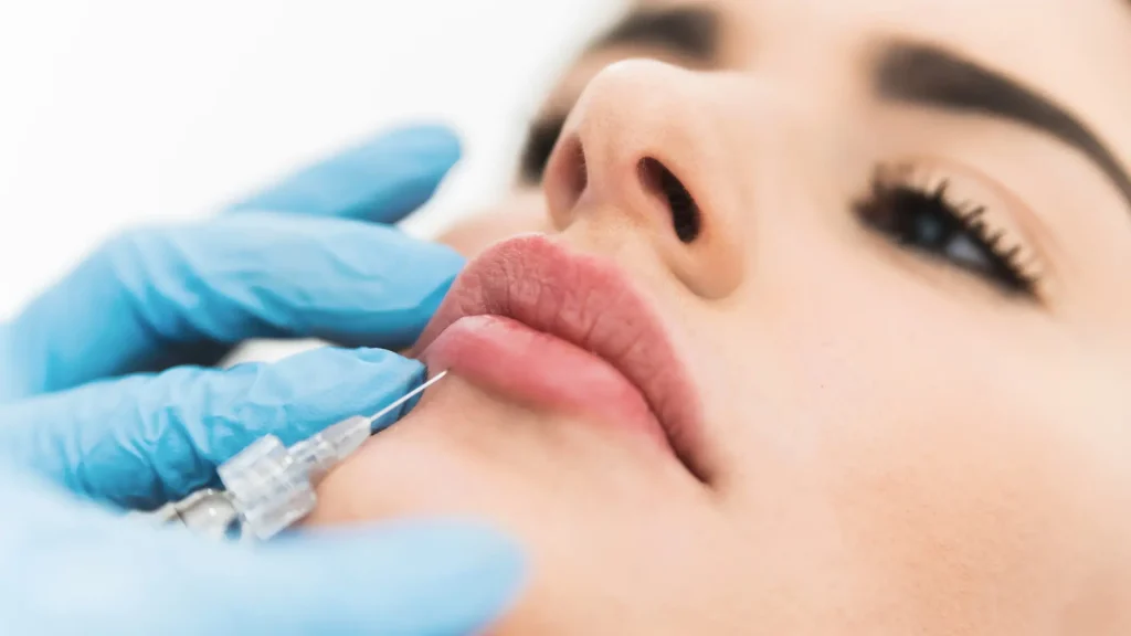 An individual undergoing a lip injection treatment.