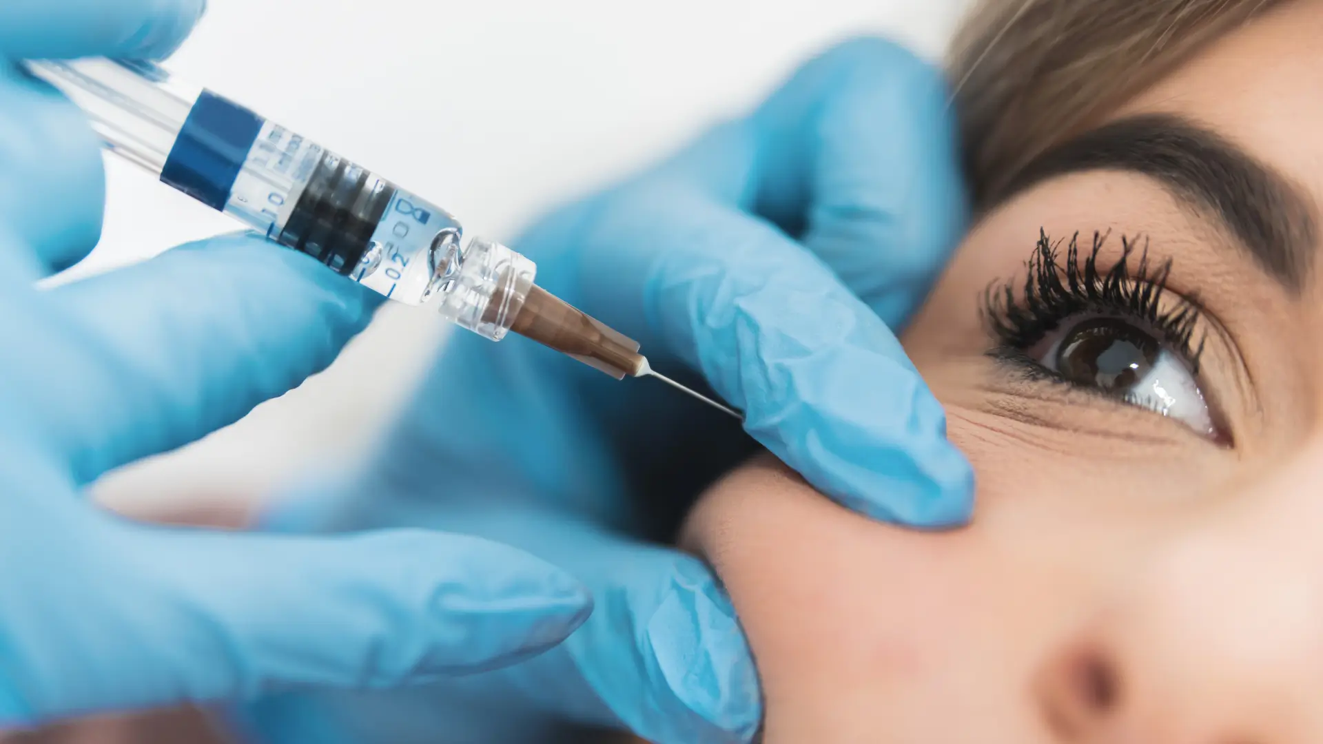 A medical professional administering a filler injection into a patient's midface.