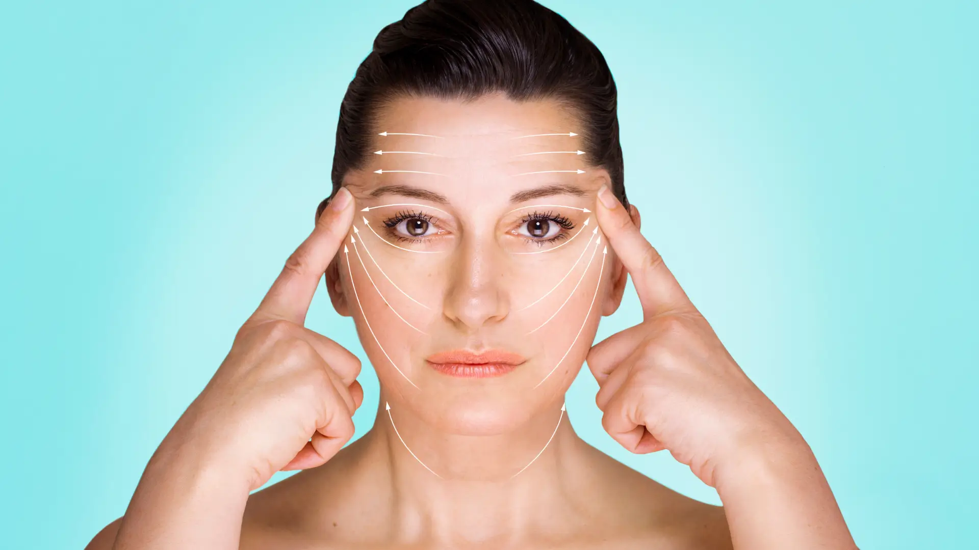 A woman's marked face for their facelift procedure.