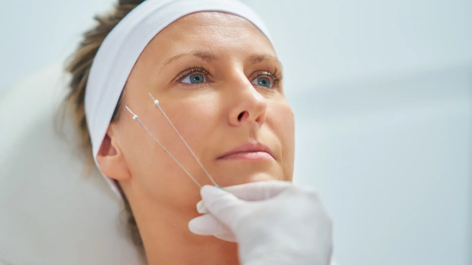 A patient preparing for their thread lift treatment.