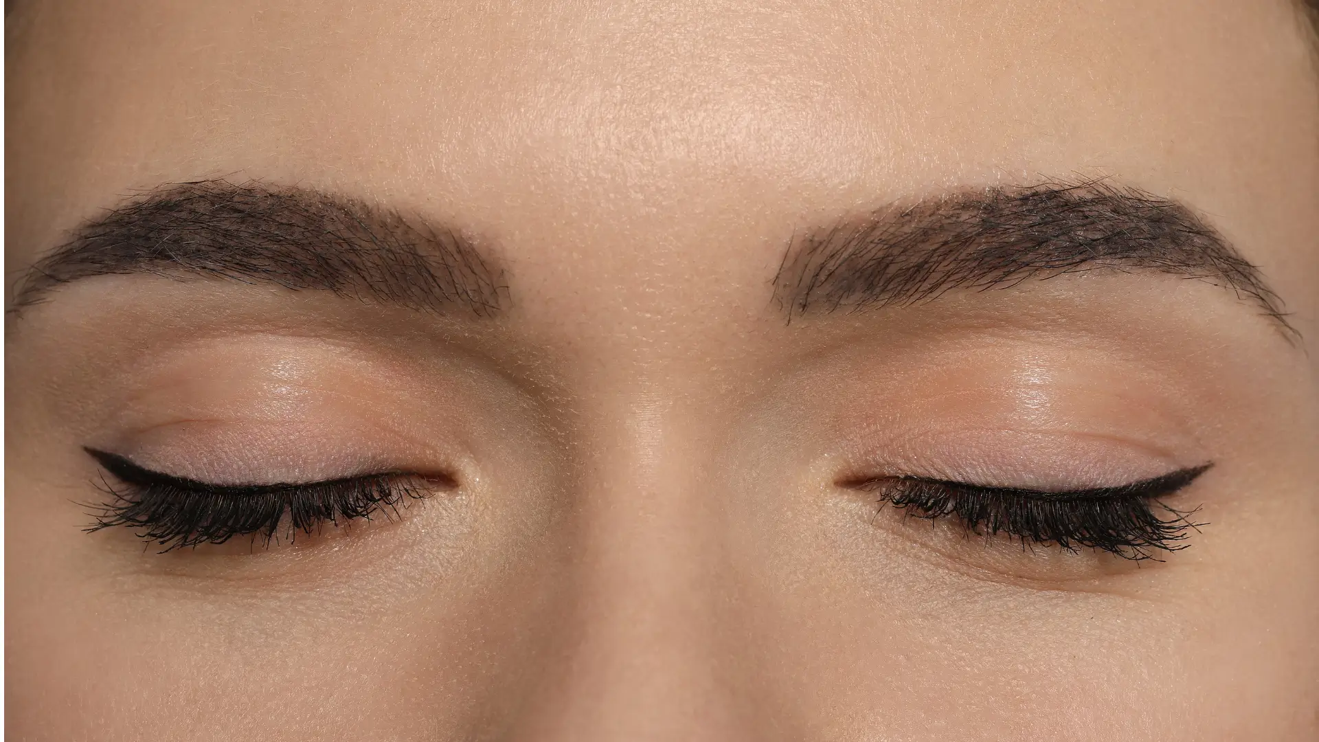 An individual showing their improved brow region and lift.